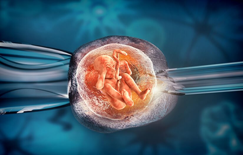  Embryo Transfer