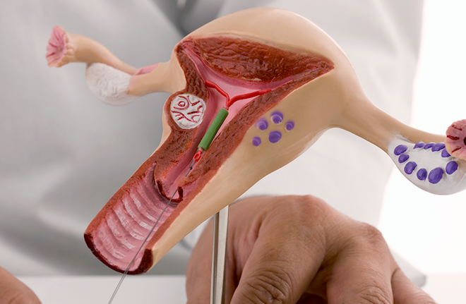 Insemination